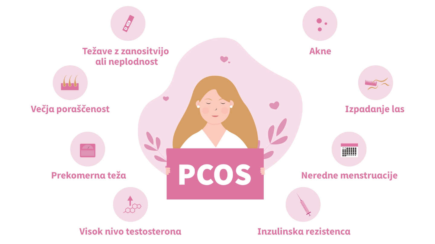 Infografika mogućih simptoma PCOS-a.